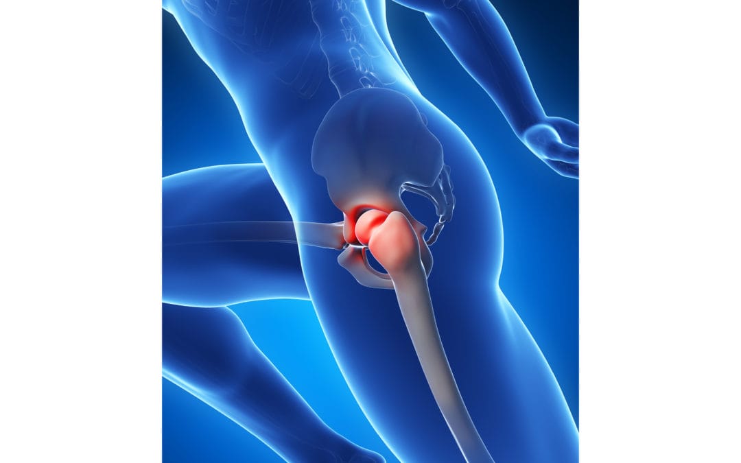 Regenerative Therapies Bring New Hope for Healing Hip Labral Tears