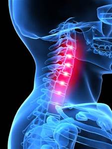 New Regenerative Therapies Offer Long-Lasting Solution for Chronic Neck Pain