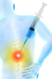 Diagnosing Pain with Steroid Injections Before Regenerative Treatments