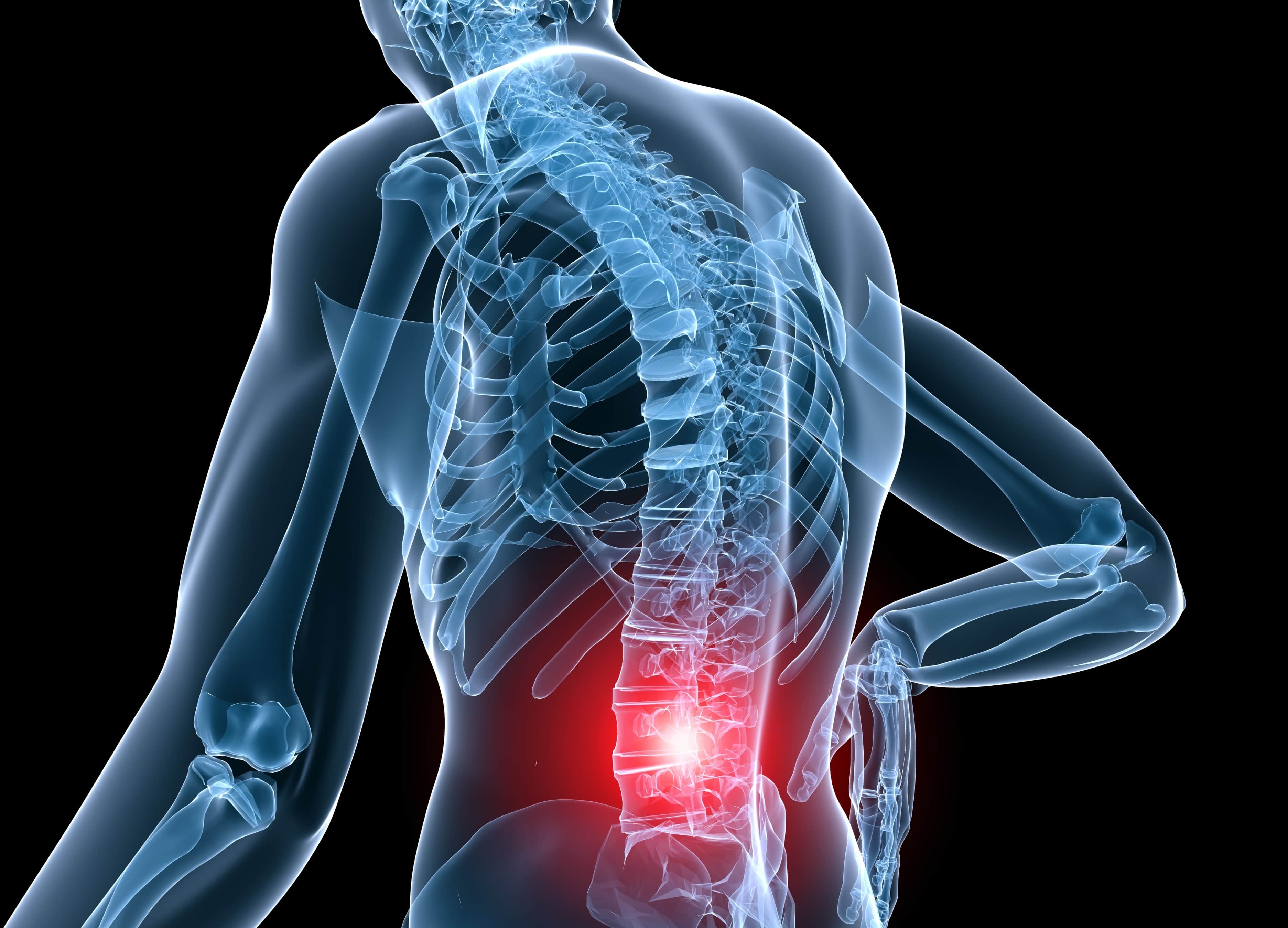 The Anatomy of Lower Back Pain, Low Back Pain